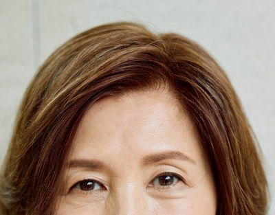 冨田由美子さんの額から目もとにかけての寄り。ウィッグの生え際が自毛と見分けがつかない