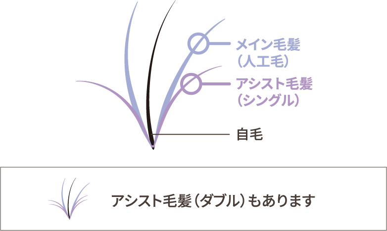 メイン毛髪(人工毛)アシスト毛髪(シングル)自毛