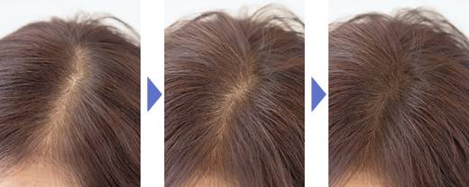 �C�ɂȂ�Ƃ���ɂق����������v���X