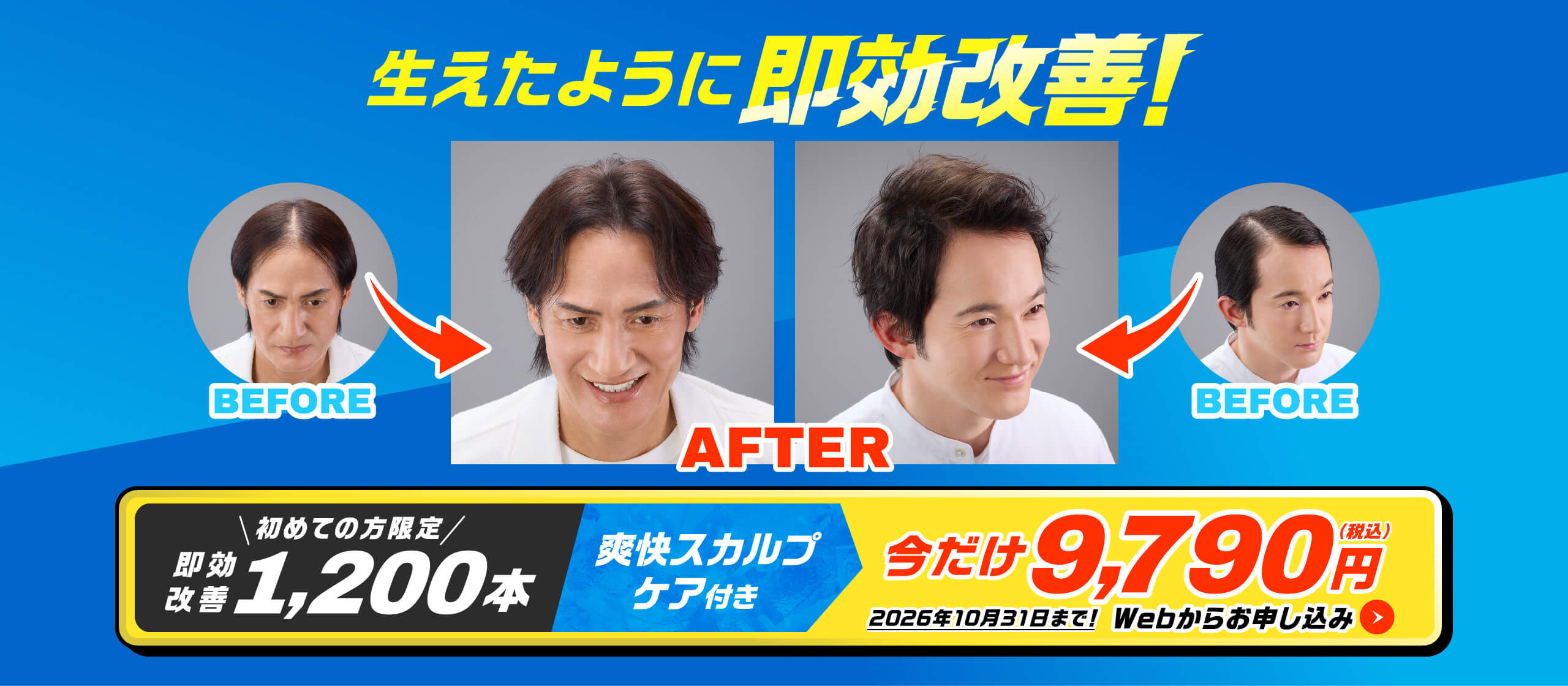 生えたように即効改善！　即効改善1,200本 爽快スカルプケア付き 今だけ9,790円(税込) 2026年10月31日まで！Webからお申し込み
                  width=