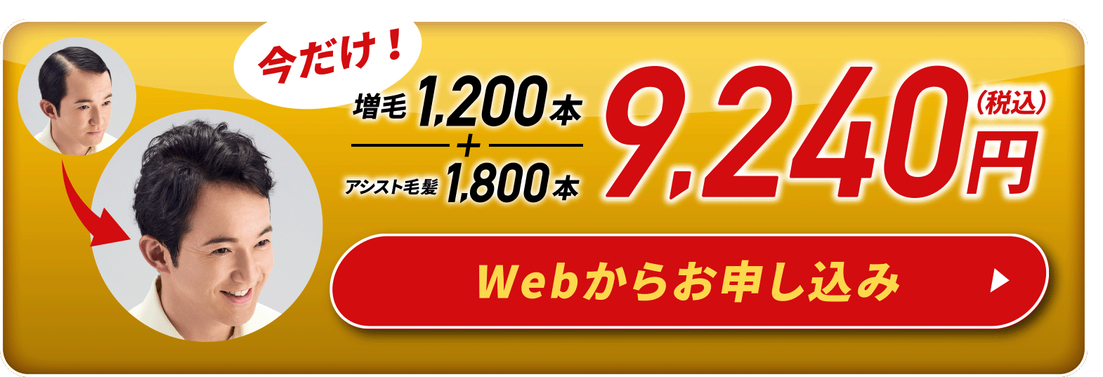 今だけ！増毛1,200本＋アシスト毛髪1,800本 9,240円（税込）Webからお申し込み
