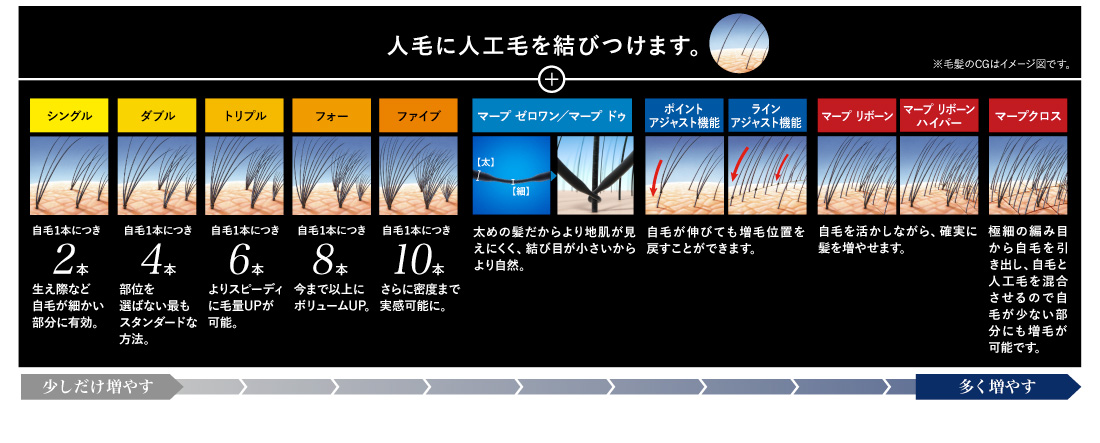 Mrp マープ 増毛 かつらはアートネイチャー