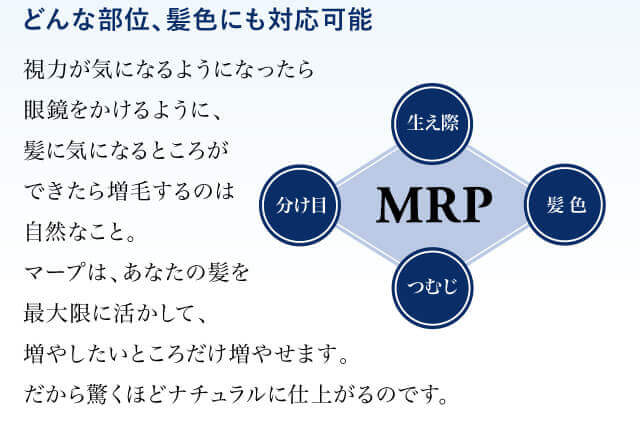 Mrp マープ 増毛 かつらはアートネイチャー